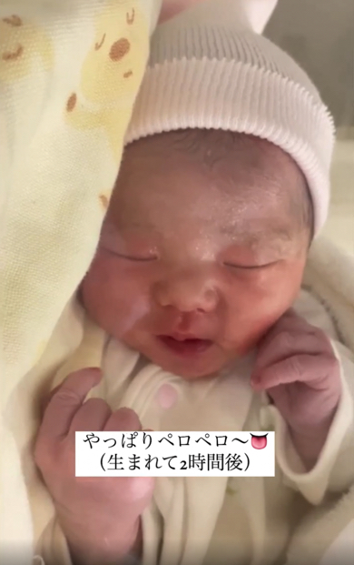 おなかの中で見せたクセを出産後にもしていた赤ちゃん