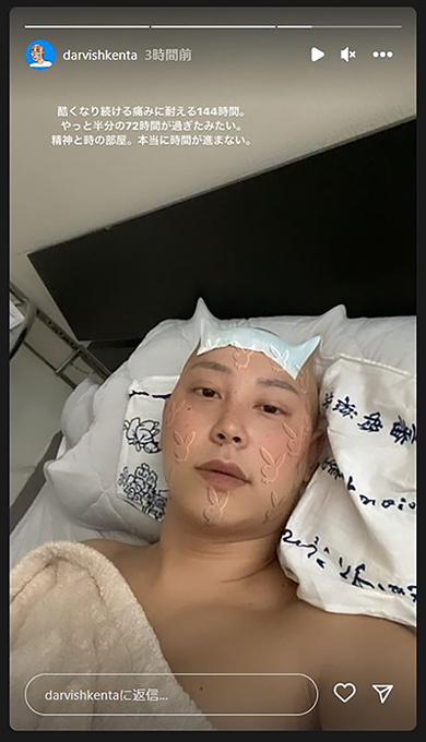 ダルビッシュ賢太　ダルビッシュ有　精巣がん　がん治療