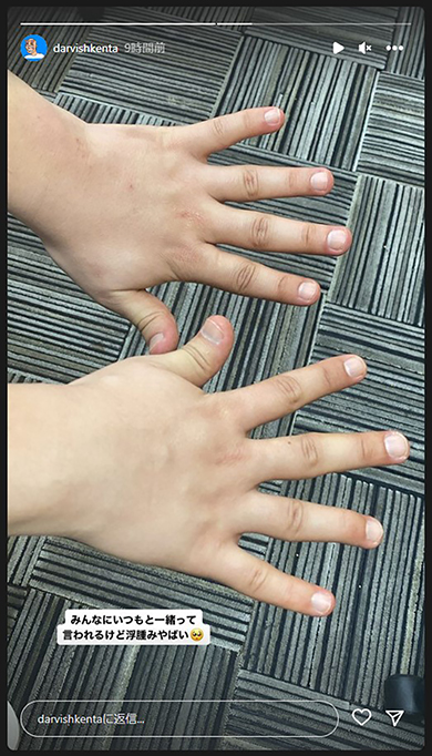 ダルビッシュ賢太　ダルビッシュ有　精巣がん　がん治療