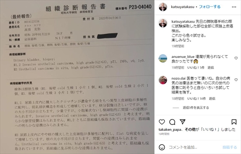 新たに尿路上皮がんが発覚した高須克弥院長