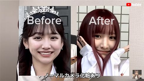 鼻の整形を報告した重川茉弥