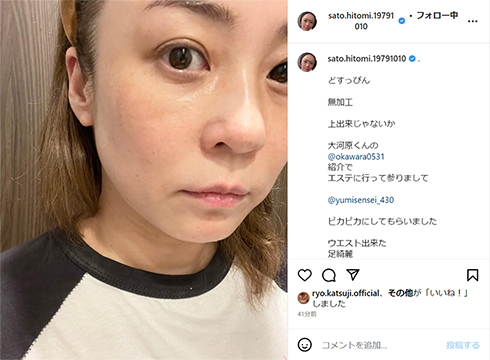 佐藤仁美さんがすっぴんを披露