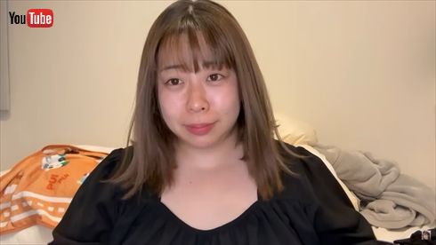 円形脱毛症を公表した餅田コシヒカリ