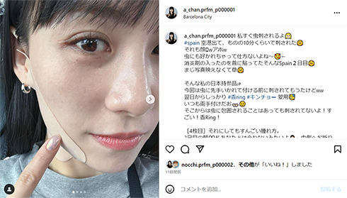 スペインで顔を虫に刺された「Perfume」のあ〜ちゃんこと西脇綾香