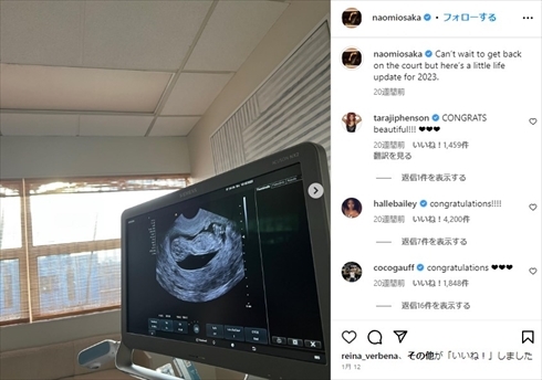 大坂なおみが公開した胎児のエコー写真