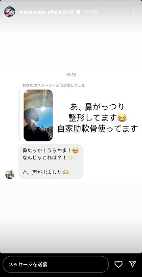 鼻の整形を明かしたMatt