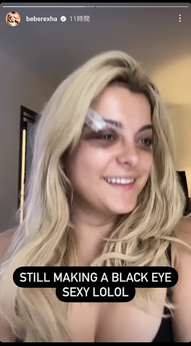 ビービー・レクサ