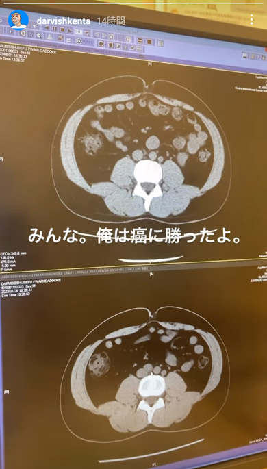 ダルビッシュ賢太Instagram