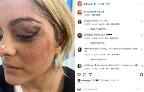 歌手のステージにファンが物を投げる事件が横行