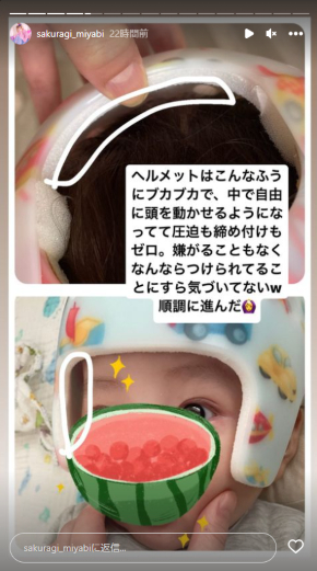 0歳息子の絶壁頭をヘルメット治療した「姉ageha」モデルの桜季雅