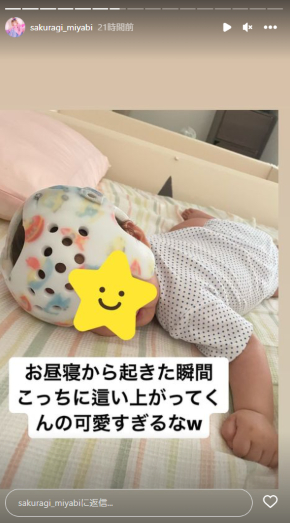 0歳息子の絶壁頭をヘルメット治療した「姉ageha」モデルの桜季雅