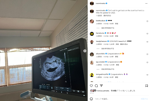 大坂なおみが妊娠発表時に公開したエコー写真