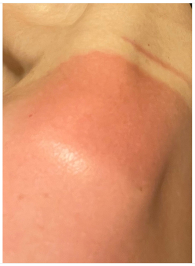 日焼けをしてしまった水野真紀