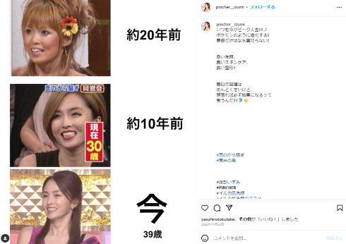 整形額1000万円を公表した元「恋のから騒ぎ」出演者の渡部いずみ