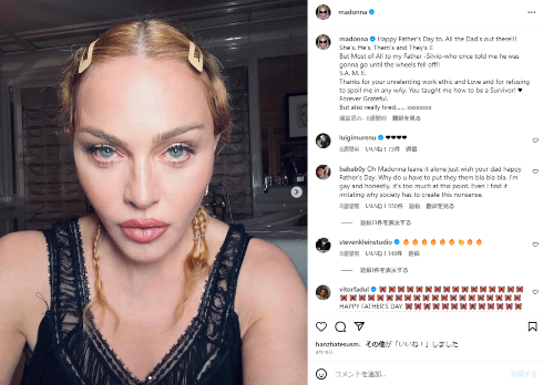 細菌感染症でICUに入っていたマドンナ