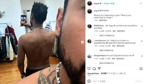 肌に直接フックを取り付ける宙づりに挑んだミゲル