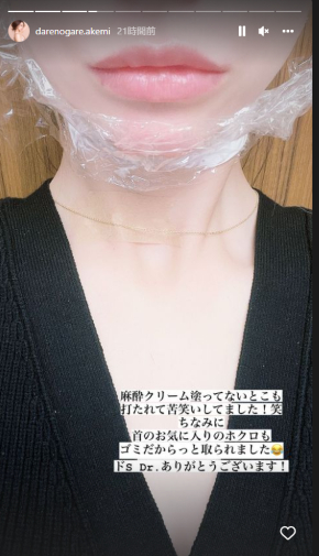 首筋のホクロを除去後のダレノガレ明美