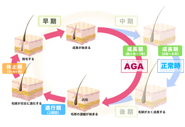 AGA治療　銀座総合美容クリニック