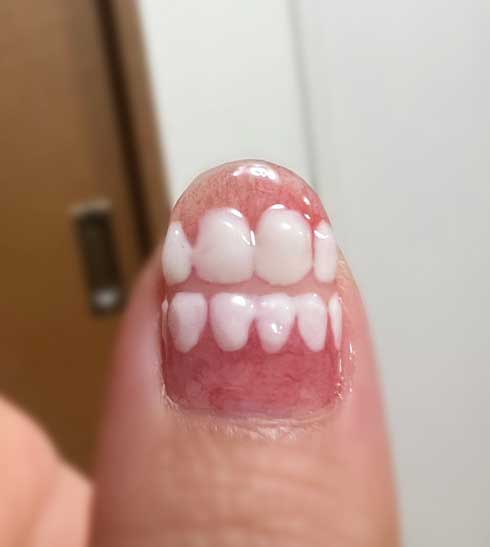 セリア ジェルネイル 入れ歯 ネイル デザイン