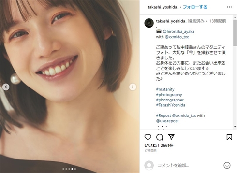 弘中綾香アナウンサーのマタニティーフォト