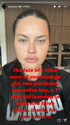 整形疑惑を否定したアドリアナ・リマ