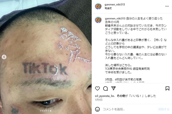 顔面ニキタトゥー