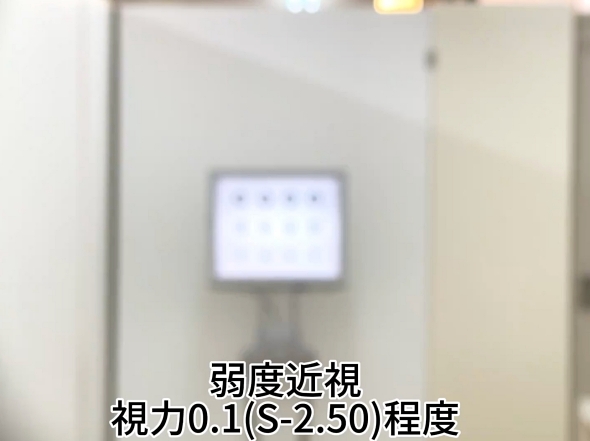 視力 近視 眼科