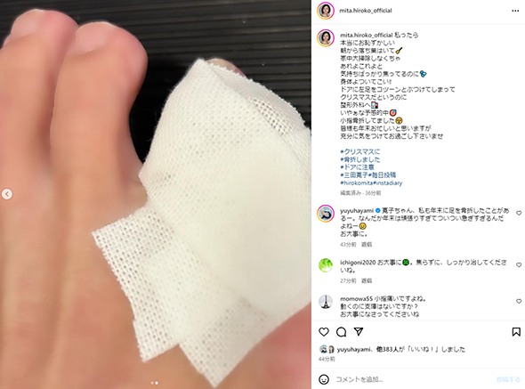 小指を骨折した三田寛子