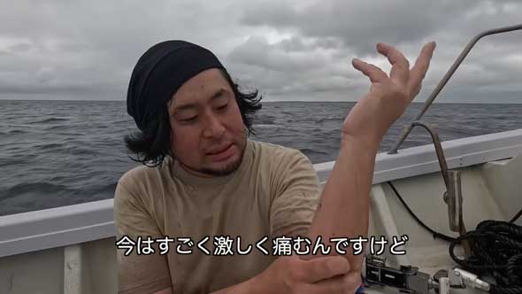 深海 巨大魚 毒針 生物 ウスエイ 尾 トゲ 毒棘 腕を刺されたら