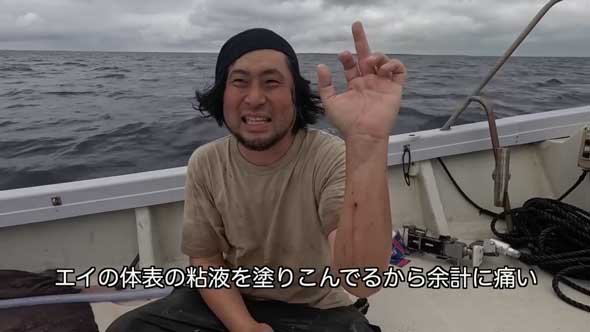 深海 巨大魚 毒針 生物 ウスエイ 尾 トゲ 毒棘 腕を刺されたら