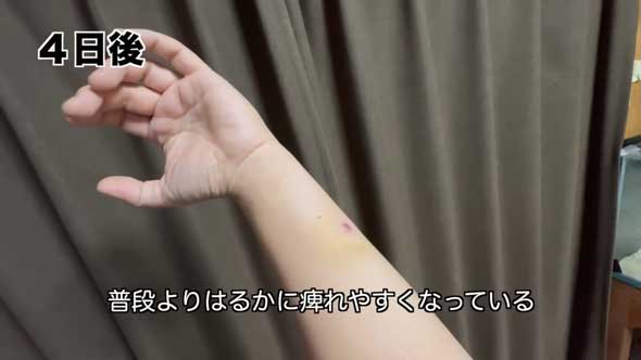 深海 巨大魚 毒針 生物 ウスエイ 尾 トゲ 毒棘 腕を刺されたら