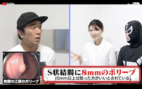 要手術の大腸ポリープが発見された江頭2:50