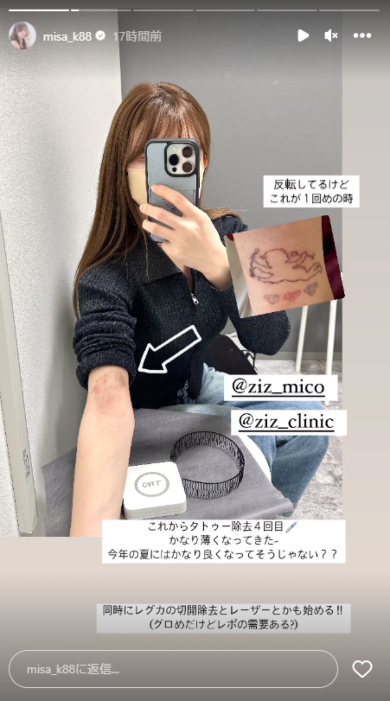 4回目のタトゥー除去を報告した黒崎みさ