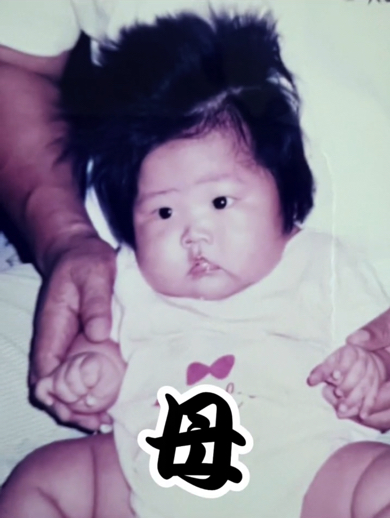 多毛赤ちゃんの母はもっとすごかった