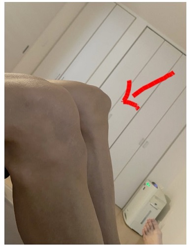 アレク白血病付き人