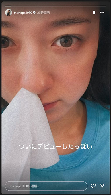 花粉症デビューしたみちょぱ