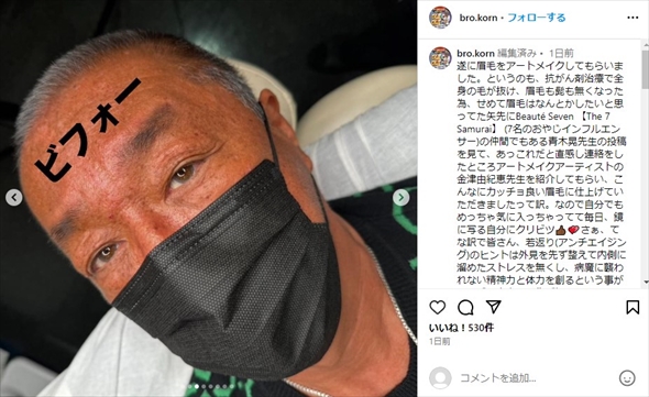 眉毛のアートメイク施術を受けたブラザー・コーン