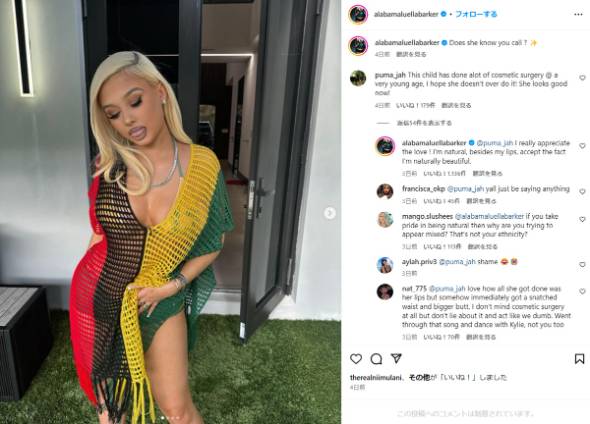 アラバマ・バーカー、美容整形疑惑に回答