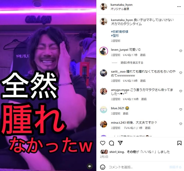 カマたく整形失敗