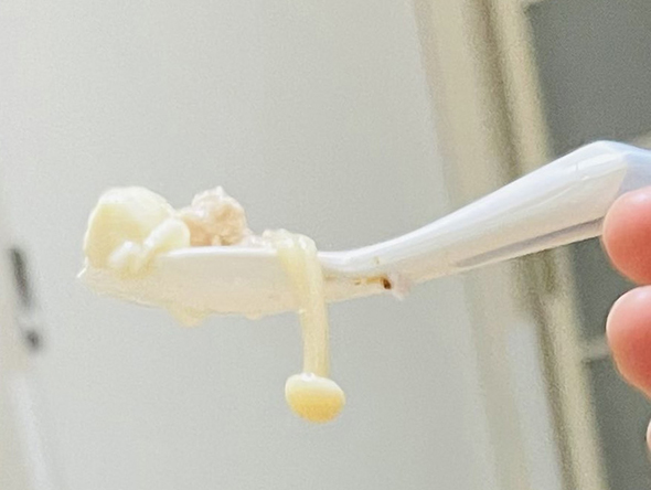 スプーンアップ