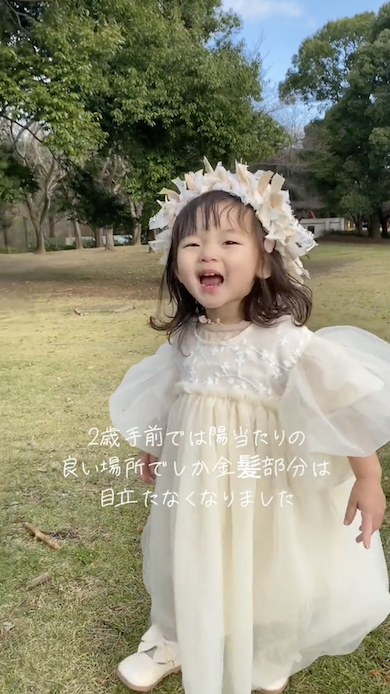 2歳になる手前のころ