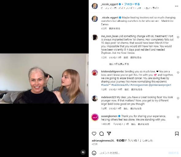 乳がん闘病中のニコール・エガート、髪をそった姿を投稿