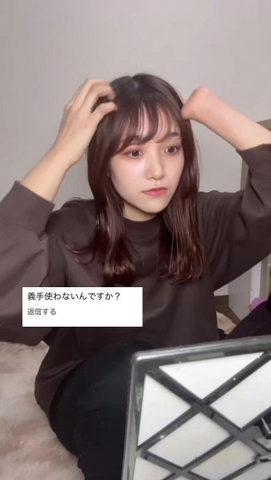 義手は使わないのかとの質問に対して自分の考えを伝える先天性四肢障害の女性