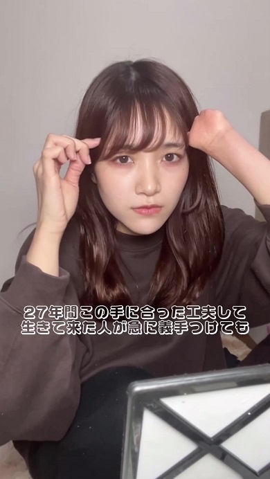 義手は使わないのかとの質問に対して自分の考えを伝える先天性四肢障害の女性