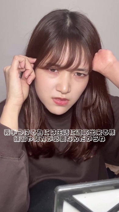 義手は使わないのかとの質問に対して自分の考えを伝える先天性四肢障害の女性