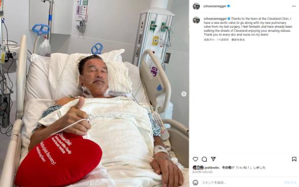 アーノルド・シュワルツェネッガーがペースメーカーを入れたことを公表