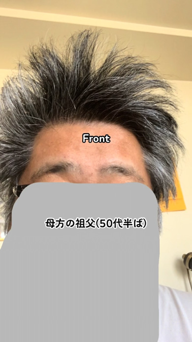 多毛赤ちゃんの寝癖