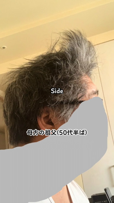 多毛赤ちゃんの寝癖