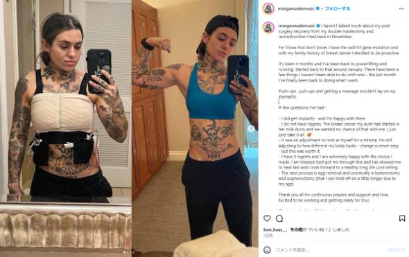 モーガン・ウェイドが予防的乳房切除術を受けた体験を語る