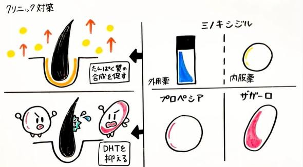 【PR】 イースト駅前クリニック AGA治療 薄毛 抜け毛